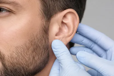 Otoplastie — urechi clăpăuge